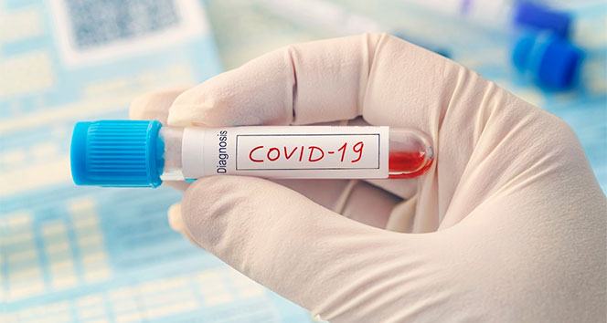 ABD’de koronavirüs salgınında ölenlerin sayısı 35 bine yaklaştı