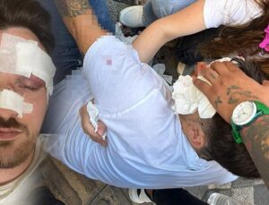 İstanbul’da maganda dehşeti: Tartıştığı motosikletli gencin üzerinden otomobille geçti