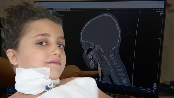 Şah damarına 2 cm! 5 yaşındaki Rahif’in oynadığı oyun hayatının en sıkıntı ameliyatına soktu