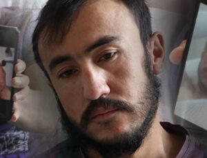 Üzerine yıldırım düştü, bu hale geldi: Bacaklarımın patladığı gözümün önüne geliyor