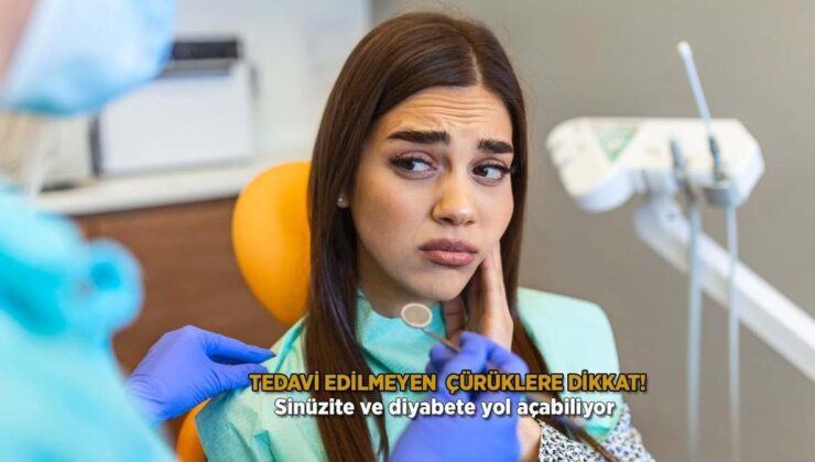 Tedavi edilmeyen çürüklere dikkat! Sinüzite ve diyabete yol açabiliyor